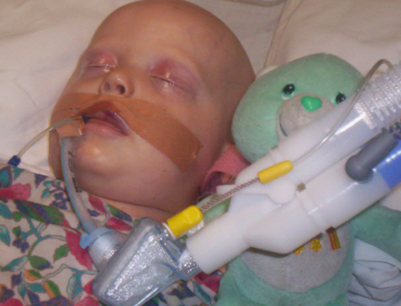 ava in hospital