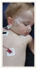 A baby with oxygen tubes and heart monitors